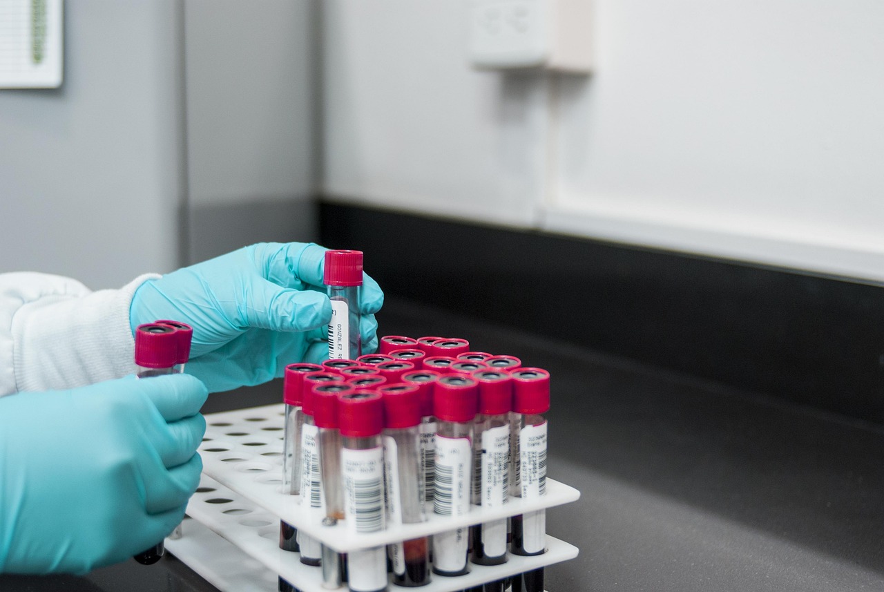 Illustratief beeld van bloedonderzoek in een laboratorium